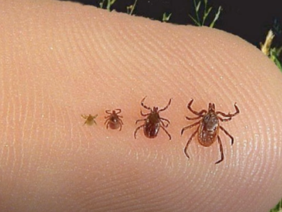 finger with four deer ticks each of various sizes